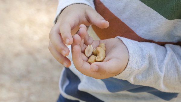 Nut Allergies, Symptoms and Treatments